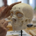 orbital fat and nasal cartilage added
