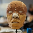 upper face muscles and superficial fat